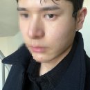 리투오 남자 1달차 후기 총정리 / 스킨보톡스 / 통증, 효과, 가격 / 남자 리투오 시술 / 대구