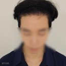 젠틀M헤어감정동점 | 영등포 두피문신 관리하는 남자들의 리얼 후기
