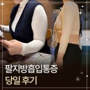 다음 | 팔뚝지방흡입통증 다음날 출근 솔직 후기