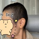 아이투피 | [공지] [30대 삼중음성 유방암 3기] 항암 후 머리 변화 남겨요 (막항 6개월 후 기록)