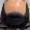 촘촘 스칼프 이미지