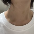 강남역목주름 노란건물에서 목주름시술한 후기