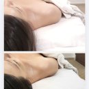 힐스파테라피 | [고양/일산] 장항동 피부관리 스파더힐 윤곽관리 솔직후기