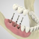 연세온아치과병원 이미지