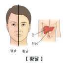 총담관 낭[Choledochal cyst]소화기질환 이미지