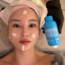 연산LG제1경로당 | 부산 슈퍼젝션 부작용 없어서 가격 값 아깝지 않는 연산동 피부관리 최정윤피부연구소 후기