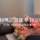 비복근 파열 후기 3탄｜3주차 회복기, 걷기는 가능하지만 달리기와 테니스는 아직 불가