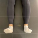 디포먼스 | 척추측만증 30대 여성 회원님 후기, 범어동피티샵 / 범어동 pt