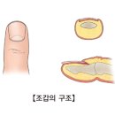 조갑주위염(Paronychia) 이미지