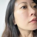 메디셀 | 메디셀 헤르덤 미간주름패치 사용 후기