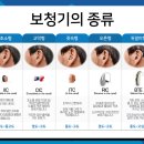 하단독일보청기 이미지