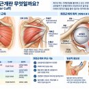 회전근개 통증에 키네시오 테이핑 적용하기 극상근과 어깨 충돌증후군 이미지