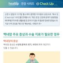 백내장 의심 증상 & 수술 고려해야 할 경우 이미지