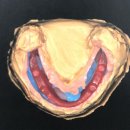 엘치과기공소 이미지