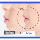 압구정아이비성형외과의원 이미지