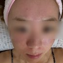 오마이뷰티 - 동구 장등로 3 | 오마이뷰티 보고 다녀온 평촌 어붐야그 레이저 피부시술 후기