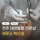 덕진-73 | 전주내성발톱 방치하다가 결국 교정 받은 후기ㅣ레푸스 전주혁신점