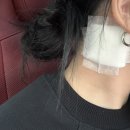 튼튼약국 | 포항 타투 레이저 (피코 레이저) 3회차
