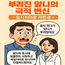 [부평치과/부평역치과/부평임플란트] 치아 파절 후 당일 임플란트 식립!