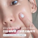 설화뷰티라인 | 신사역피부과 부작용 , 통증 걱정 덜한 정착하고 싶은 고우리 스킨부스터 40대 솔직 후기