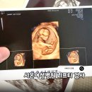 아이앤맘정신건강의학과의원 | 니프티 검사 시기 비용 비교방법 임신 12주 시온여성병원 성별결과