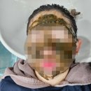 광주 광산구 두피마사지 특허받은 비법의 미라클숲 솔직후기
