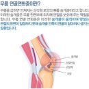 연화 | 슬개골 연골연화증 완치 후기