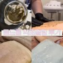 맑은 옷 | 신부케어 전 등드름 해결 “더맑은스킨 천안불당점” 등필링 과정,일주일 후기