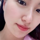 한울메디케어 | [한울뷰티센터] 광주 스마트누비아플러스 리프팅 후기