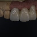 뉴치과기공소 이미지