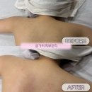 [대구 달서구 피부관리] 대구 자세 관리 관리받고 어깨라인이 바뀐 후기 3번째 재방문한 은가비 피부관리