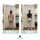 머슬 앤 필라테스 | 공덕 필라테스 머슬케어필라테스 공덕본원 구OO회원님 척추측만 목 허리통증 개선된 사례 후기