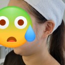 청담비포앤애프터의원 | [서울 청담] 청담동 피부과 비포앤애프터의원에서...개인 맞춤 디자인리프팅 받고 즉각 효과본 후기