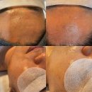 WR(부산광역시 동래구)-[충렬대로]-하-1 | 동래피부관리 두피와 피부동시에 관리하는 힐링테라피 라별하뷰티