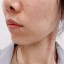티랩스 | 샤랩스 스킨부스터 대신 go한 내돈내산 렌탈 후기!!