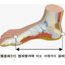 히어로 유도 클럽 | 맞춤아치교정깔창의 특징은 발길이 신발사이즈가 아닙니다