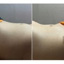 부천에스테틱 귀족뷰티 피부관리실 복부관리 솔직 후기