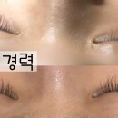 더블류성형외과 네이버블로그