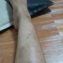 아나파적맥통증의원 이미지