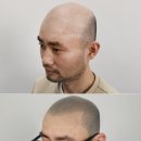 리게인프로젝트 강남본점 이미지