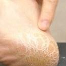 딱풀통신 이미지