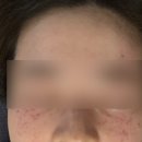 라비에피부과의원 이미지