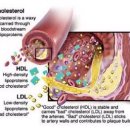 고지혈증과 콜레스테롤, LDL Cholesterol, HDL Cholesterol 이미지