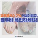 강동성신의원 | 당뇨 발톱, 당화혈색소 7% 이상이라면, 발 건강 무좀부터 확인하세요