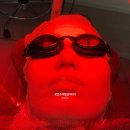 센트럴시티의원 | 논현역 도자기의원) 강남 리투오(Re2O) 스킨부스터 후기