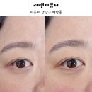 역삼-1704 | 강남 언더라인으로 선택한 리앤시뷰티에서 인생 눈매 솔직 후기 :)