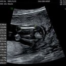 나비산부인과의원 이미지