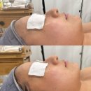 다소니네일 - 수성구 | 신림피부관리 얼굴라인 윤곽관리 다소니에스테틱 솔직후기