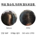 모채움스칼프