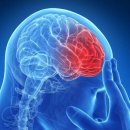 1분1초가 중요한 뇌졸중(腦卒中)…골든타임 놓치지 마세요 이미지